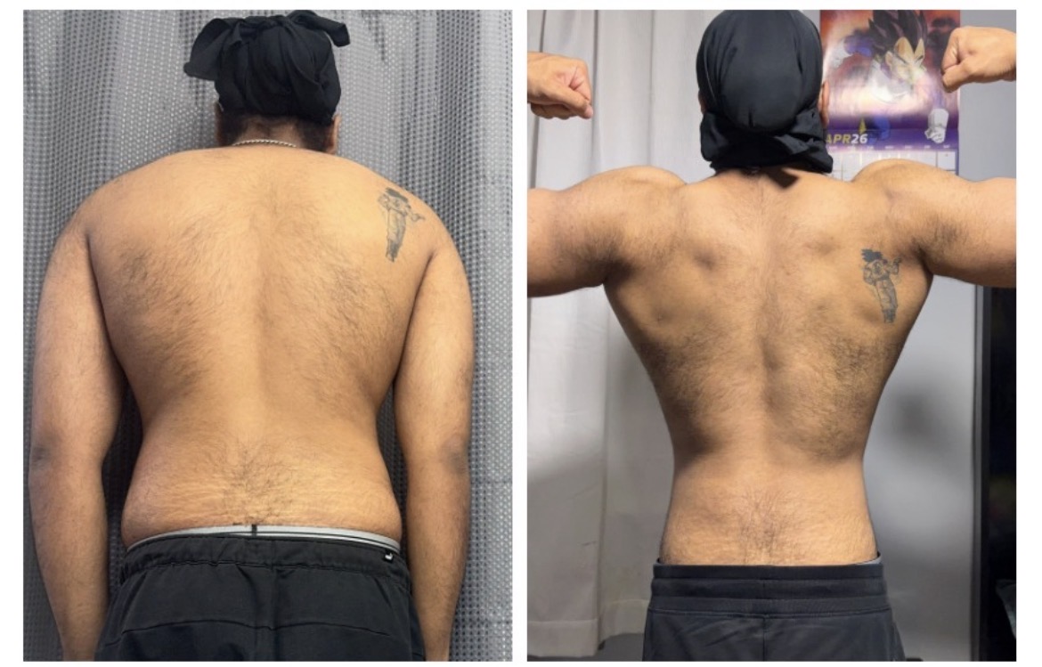 Client progress photos, gallery image 15