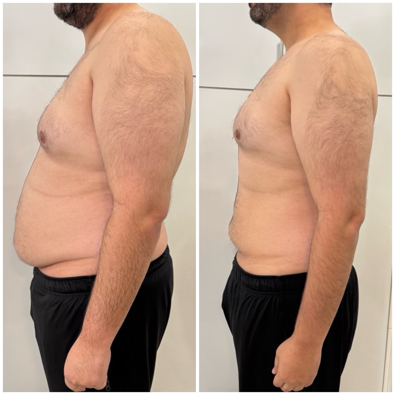 Client progress photos, gallery image 23